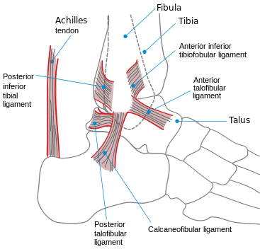 Ankle Sprain  Achilles Podiatry