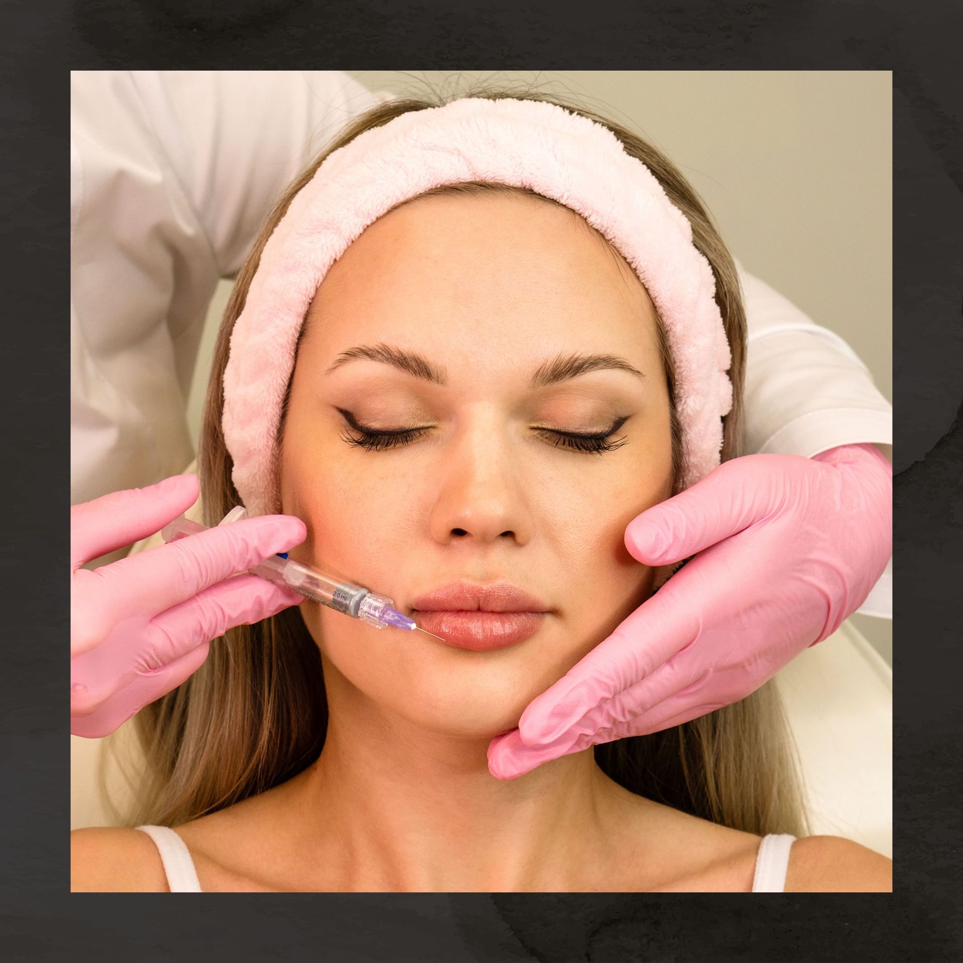 lip fillers