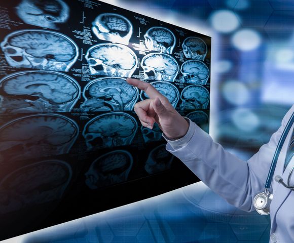 Un neurologo che esamina una tac cerebrale