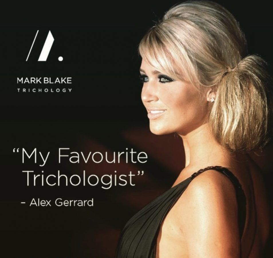 My Favourite Trichologist | Alex Gerrard