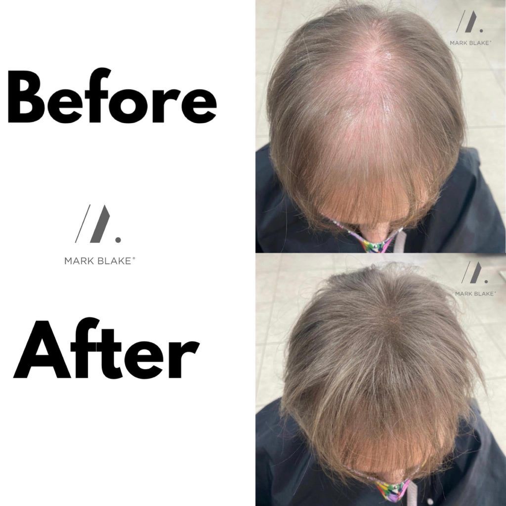 Mark Blake® Trichologist | Before & After