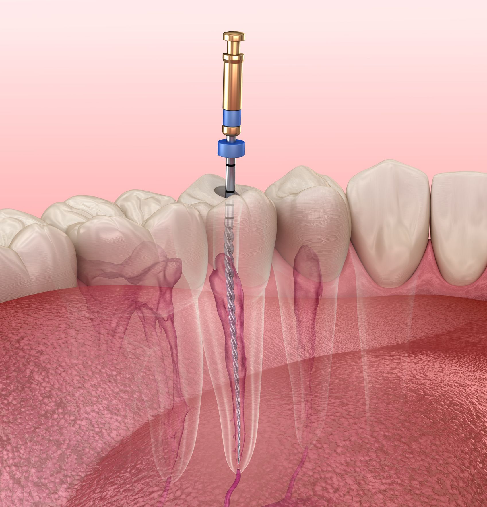 endodonzia