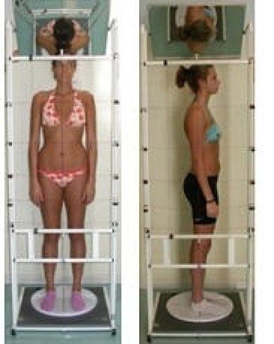 Analisi postura con scoliosometro a donna