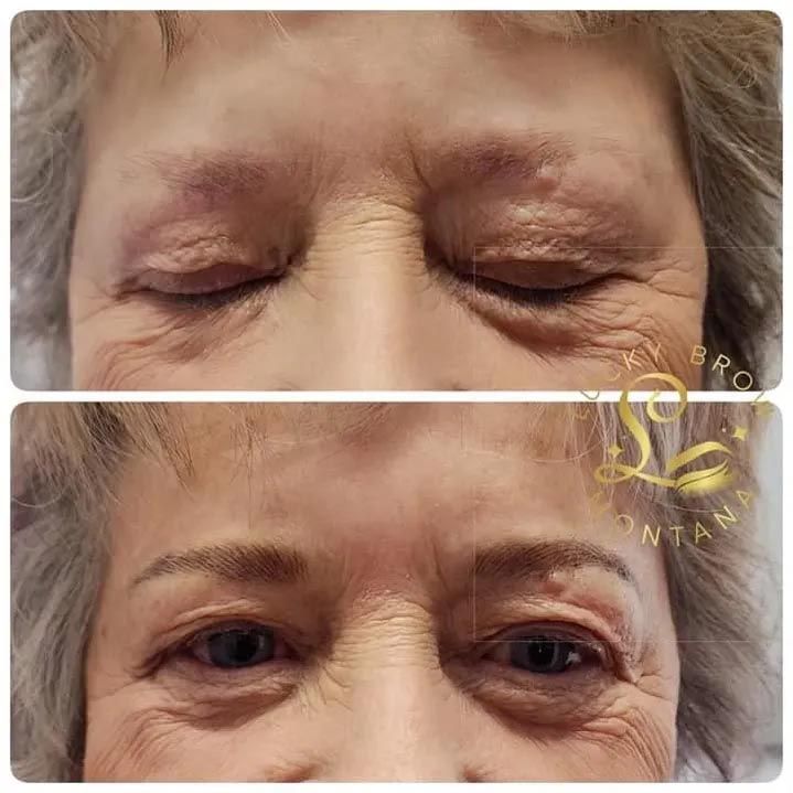 A before and after photo of an older woman 's eyebrows.