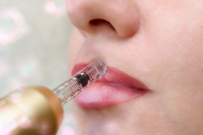 A woman is getting a botox injection in her lips.
