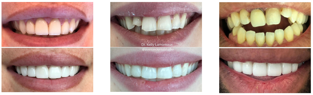 Cosmetic Dentistry Denver Greenwood Village Centennial Arapahoe