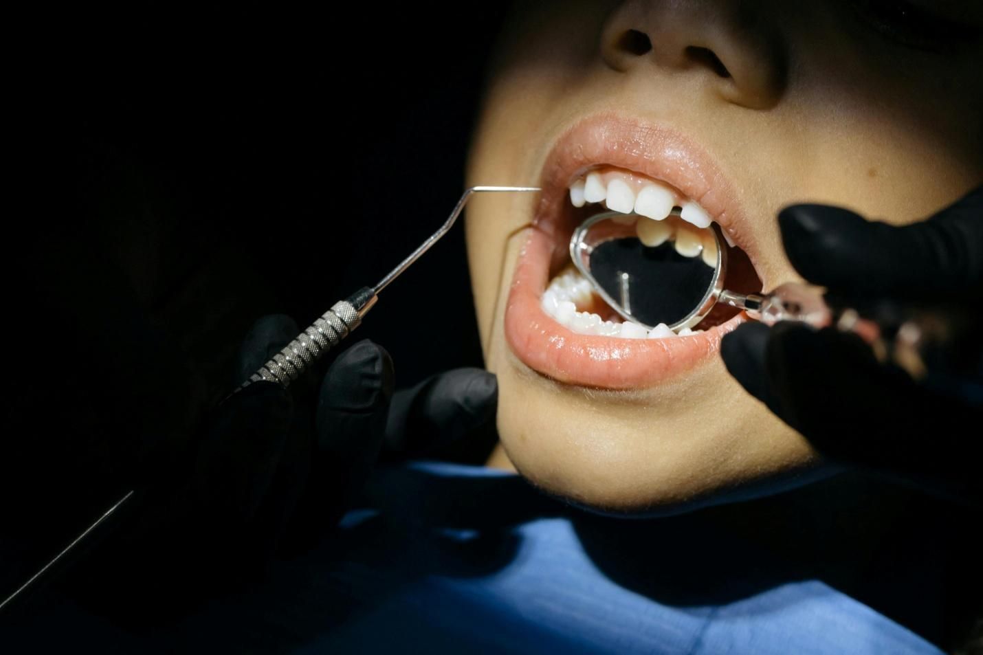 a child undergoing a dental checkup