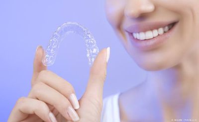 Aligner: Transparente Folie für die unauffällige Zahnregulierung