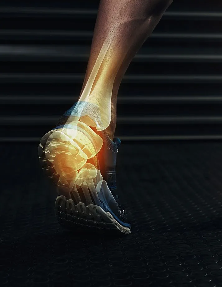 Ankle and foot, with glowing highlights indicating pain; wearing a running shoe, on a dark track.