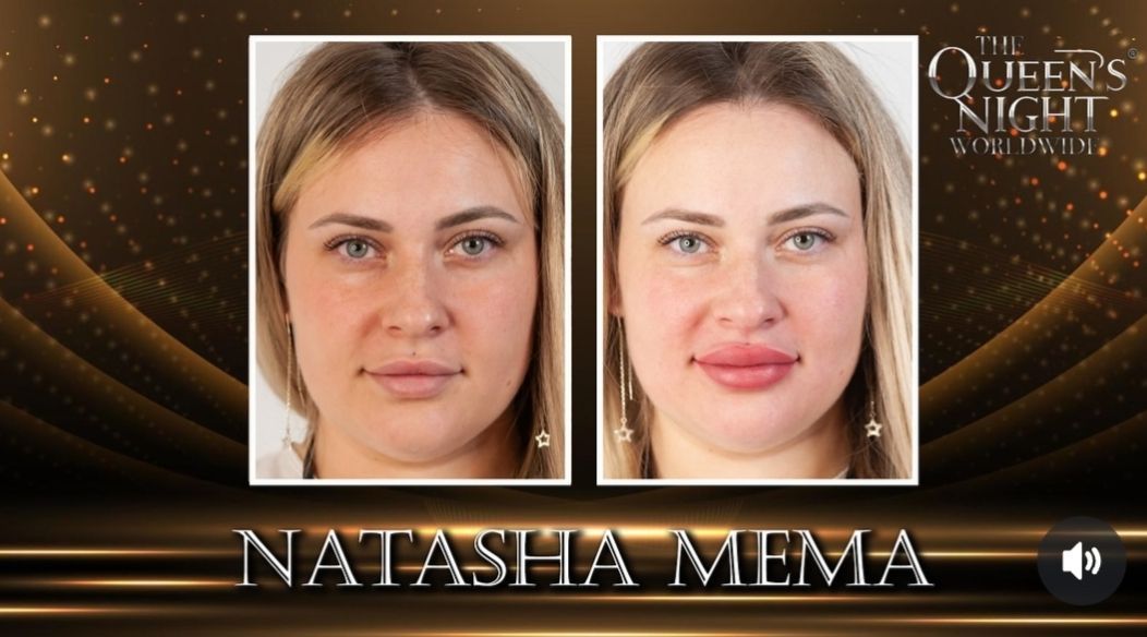 Una foto prima e dopo di una donna di nome Natasha Mema