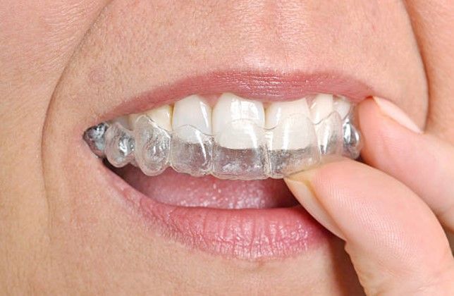 A woman is putting a clear retainer on her teeth.