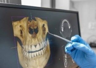 A dentist is examining a skull with a dental mirror on a computer screen.