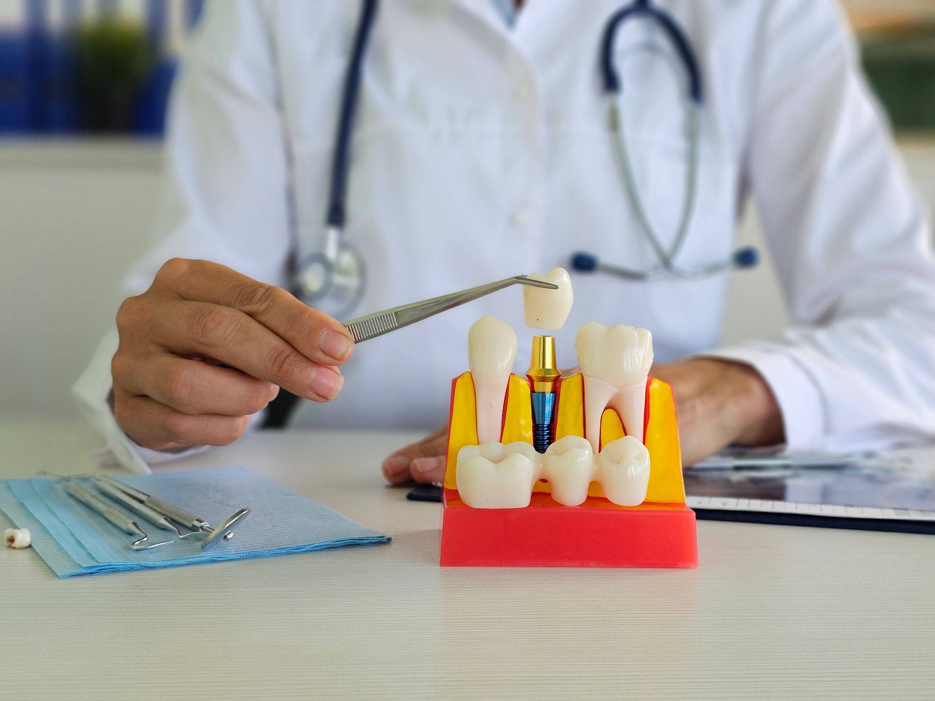 A dentist’s hand with model of human teeth. A dentist’s hand with model of human teeth.