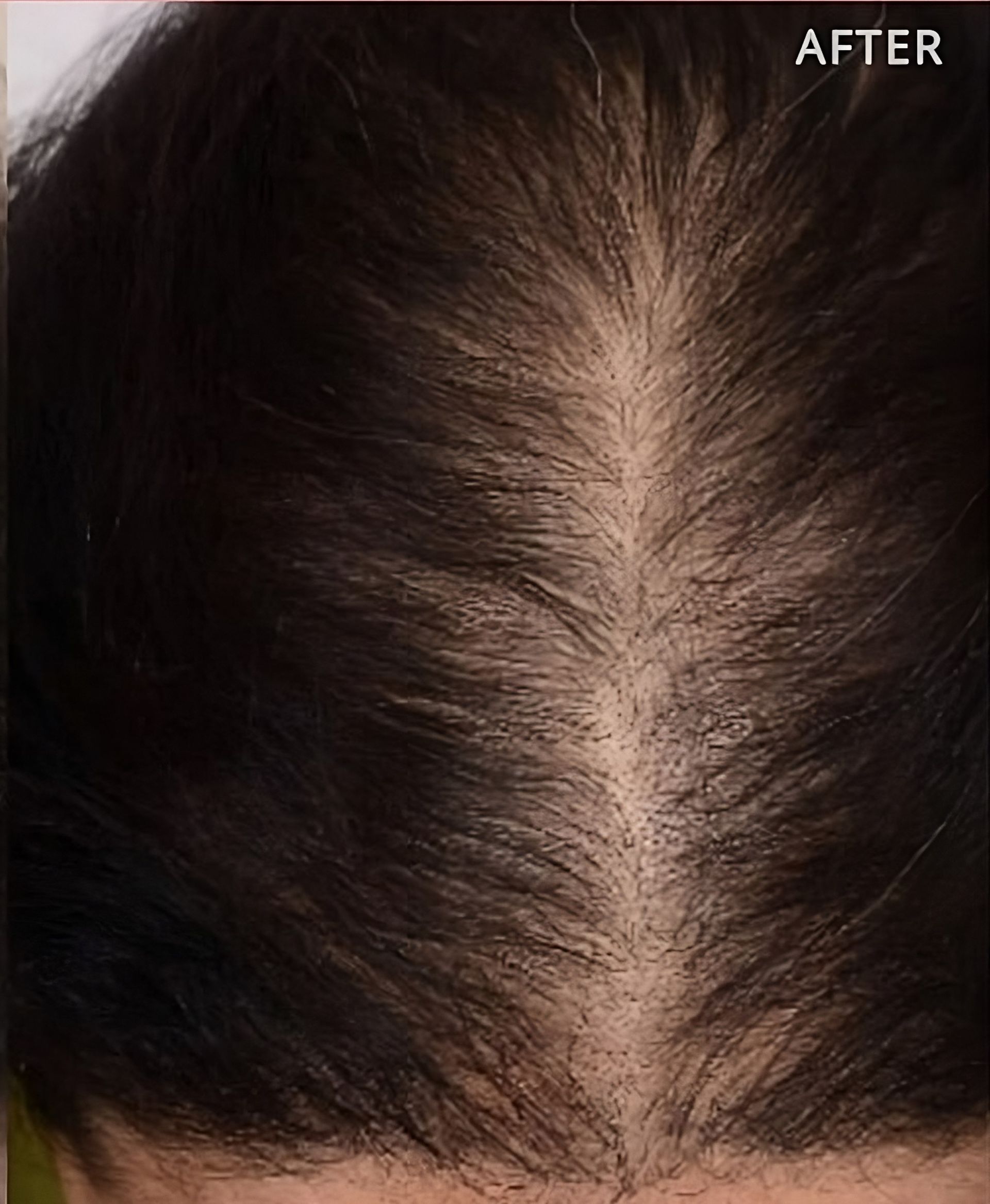 Un primer plano del cabello de una mujer después de un tratamiento.