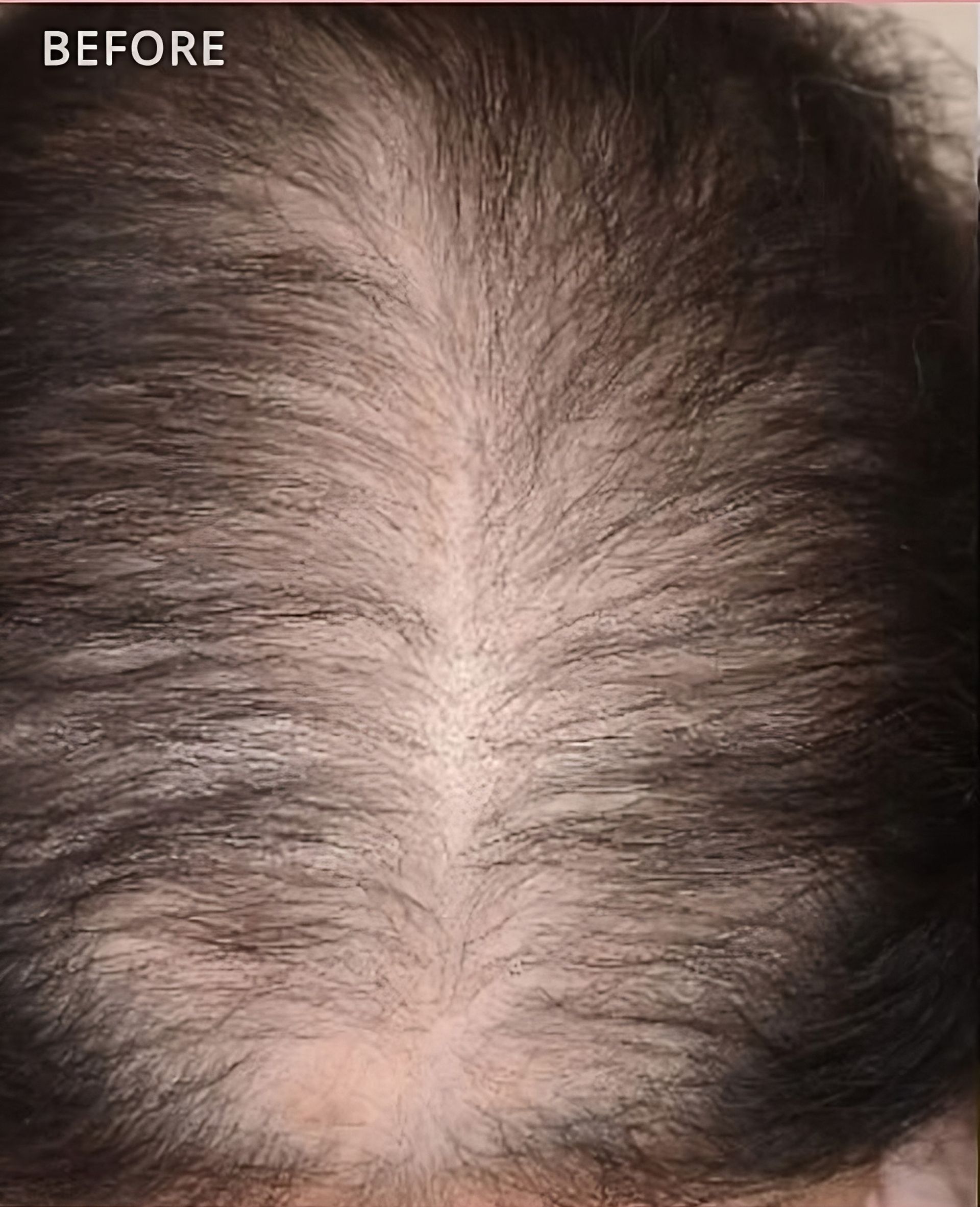 Una foto de antes y después del cabello de una persona.