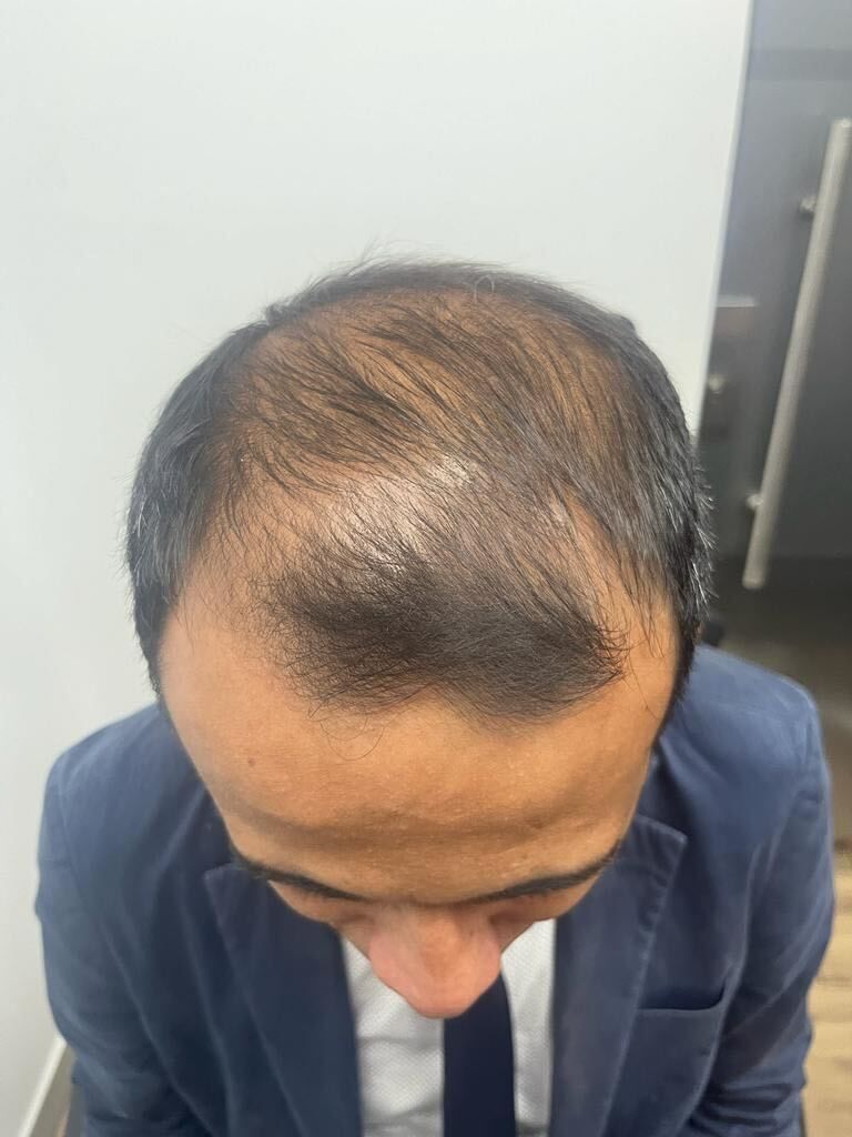 Un hombre con traje y corbata mira su cabello.