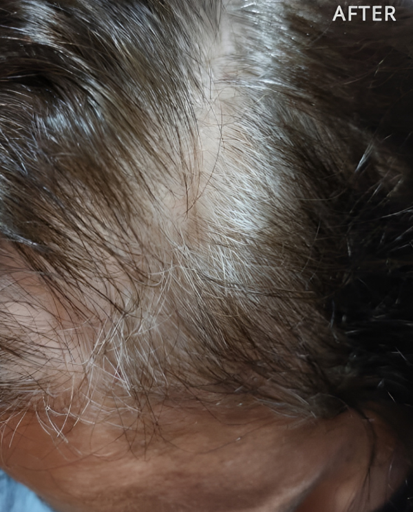 Un primer plano del cabello de una persona con las palabras después en la parte inferior.