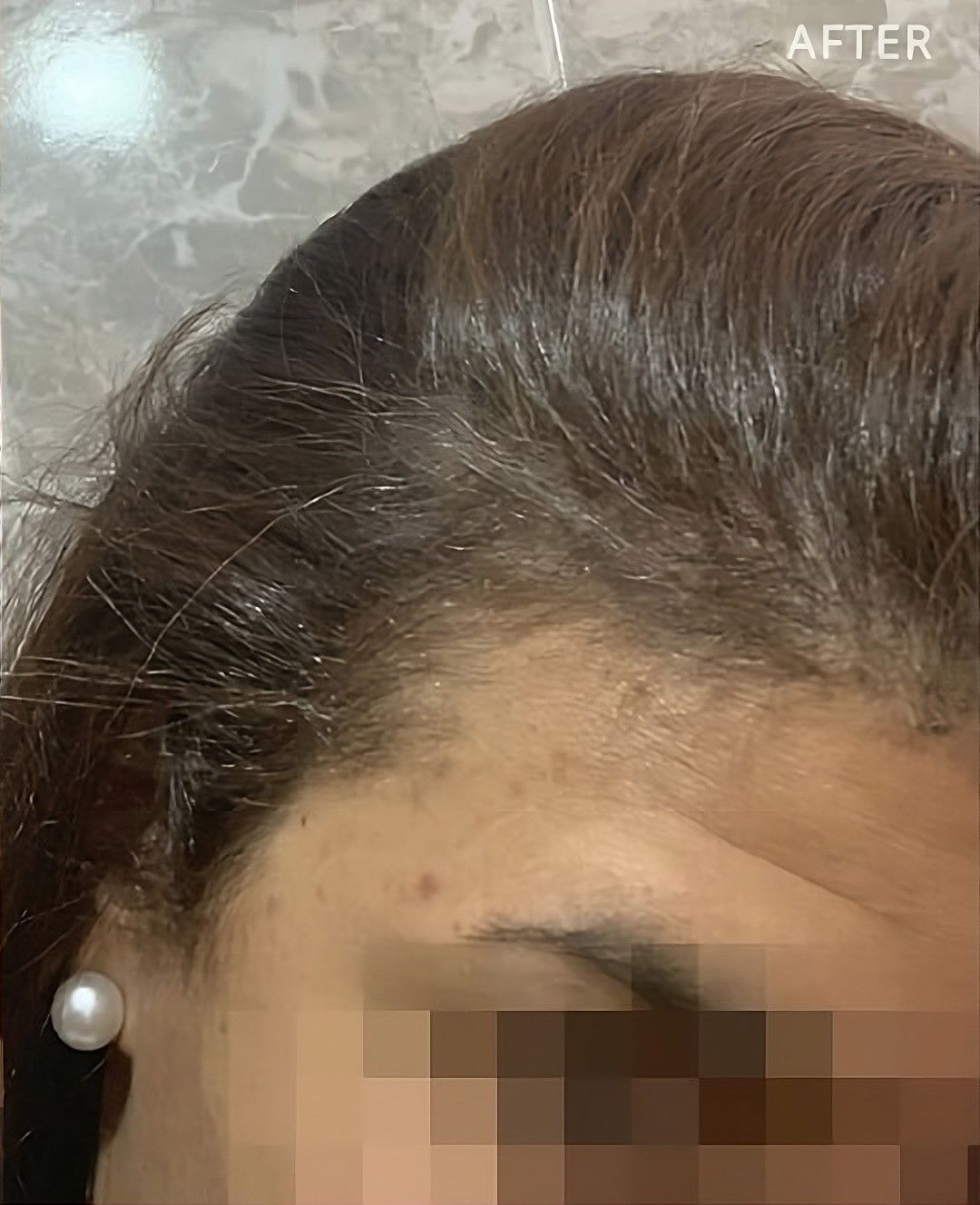 Un primer plano de la frente de una mujer con pendientes de perlas.