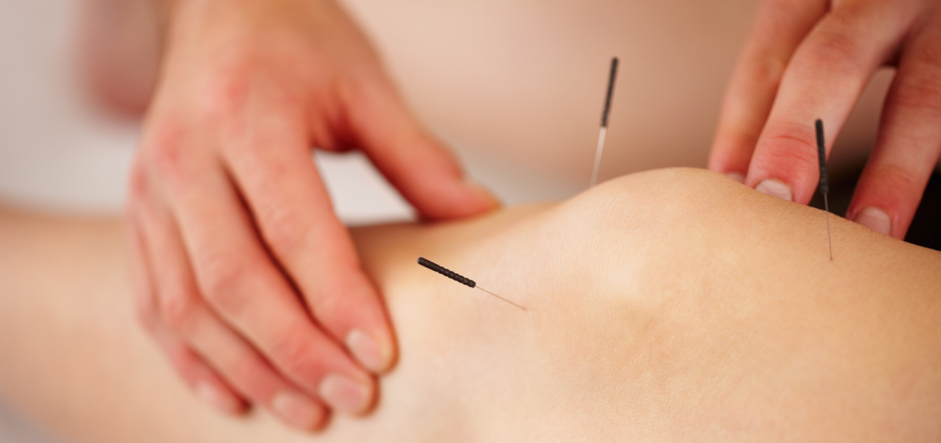 Acupuncture on patient