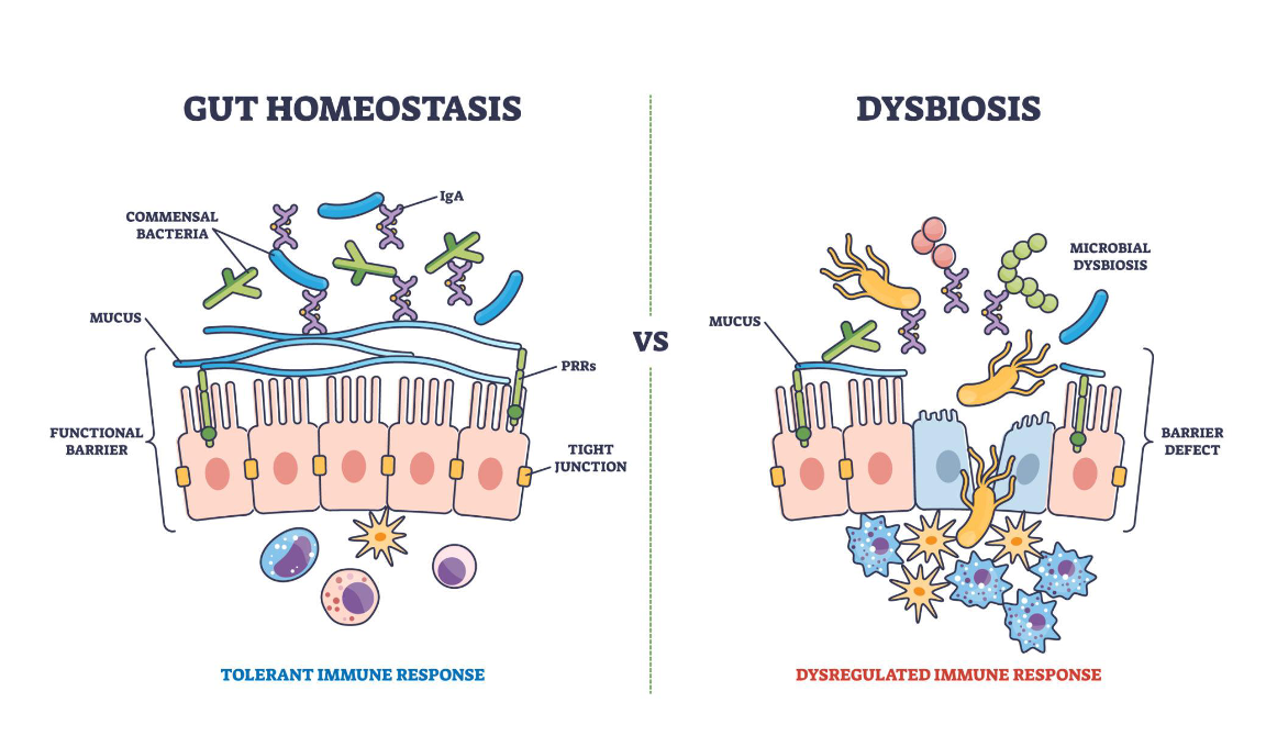 Woman in blue medical compression device, sitting in chair, talking on phone, at home.
