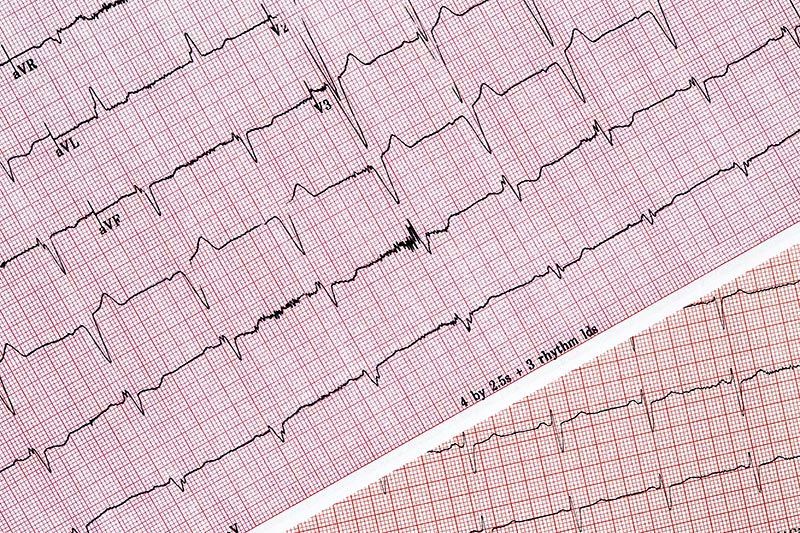 GAMMA MEDICINA NUCLEAR