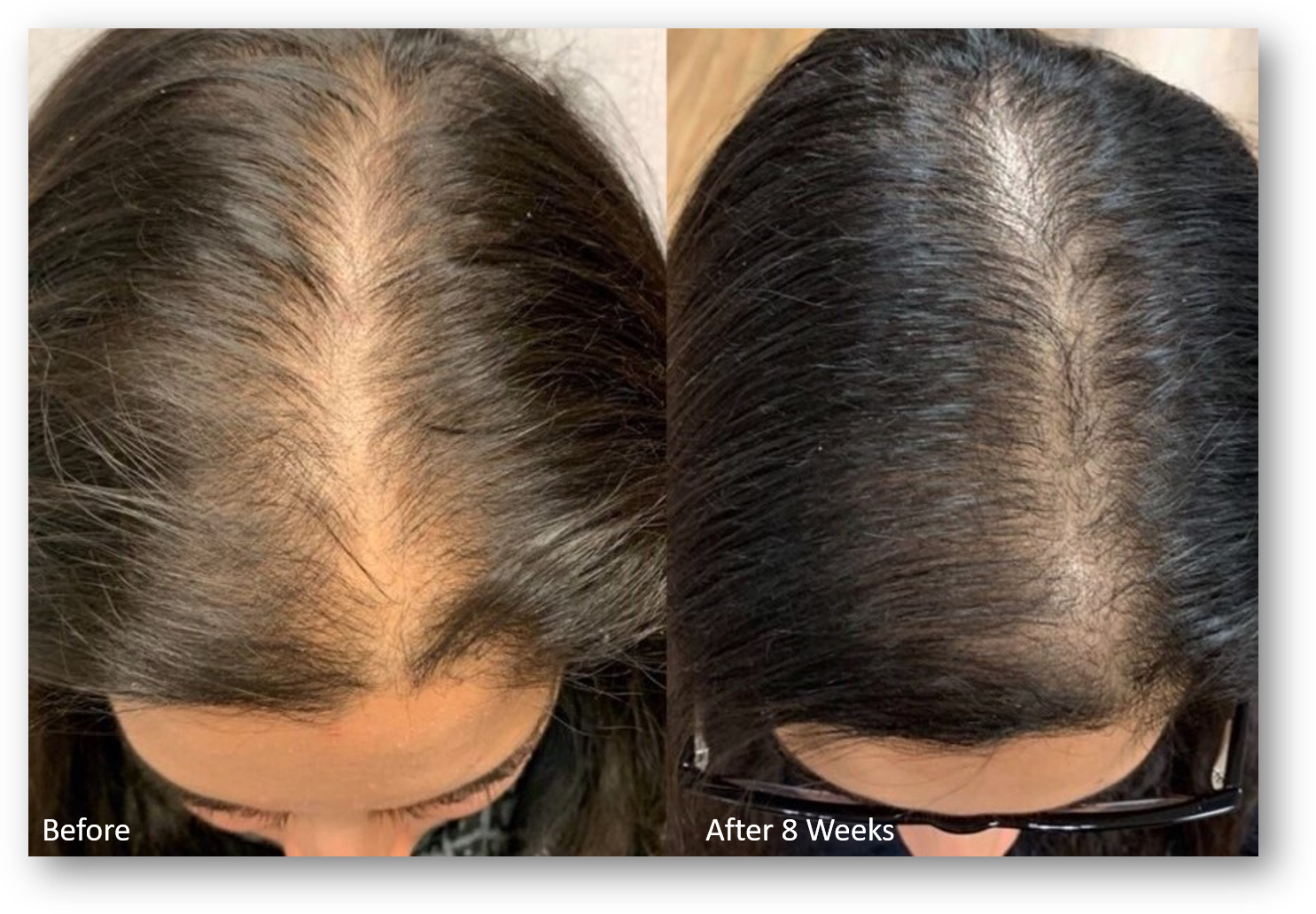 A before and after photo of a woman 's hair.
