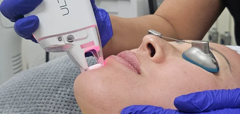 Lutronic Ultra Laser Treatment