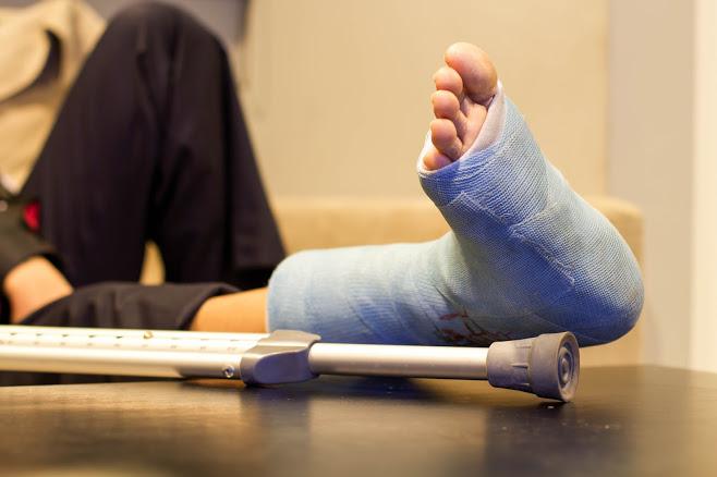 Personal Injury — Man with Casted Foot in Mariton, NJ