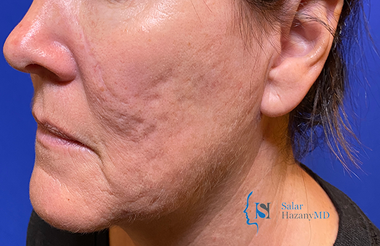 A close up of a woman 's face with a blue background.