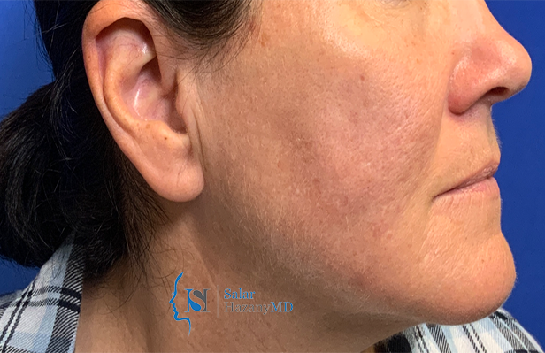 A close up of a woman 's face and neck against a blue background.