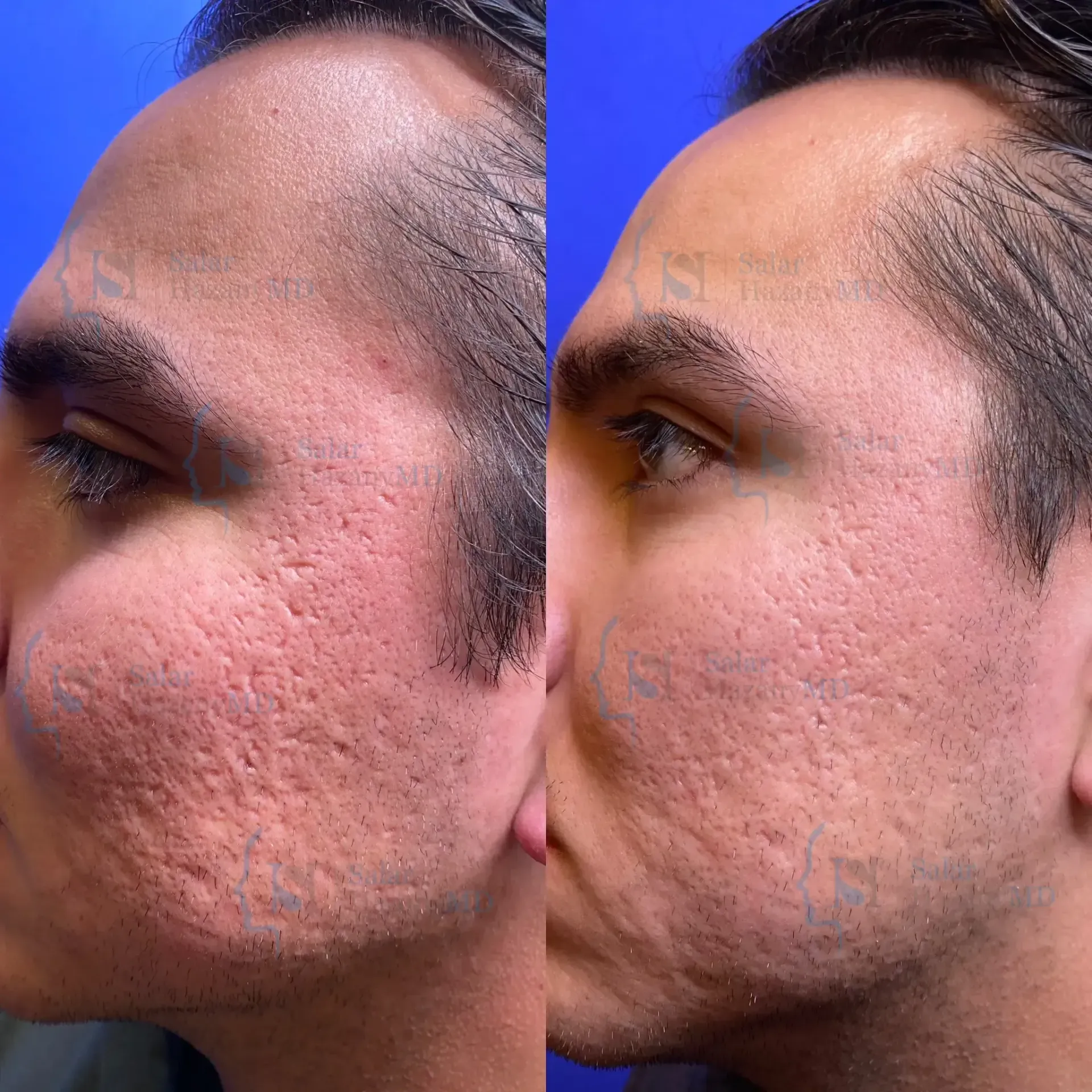 A before and after photo of a man 's face