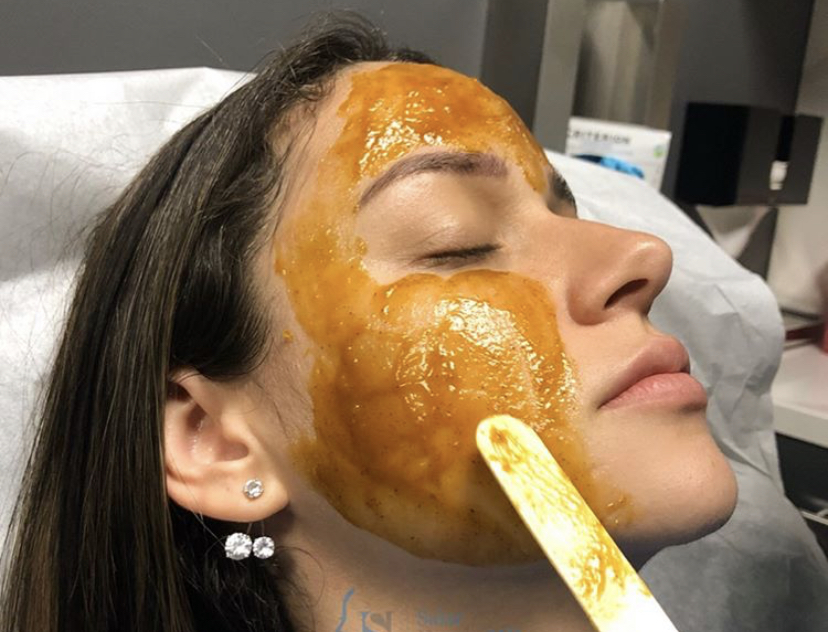 Image of Chemical Peel Application in Beverly Hills Dermatology Clinic
