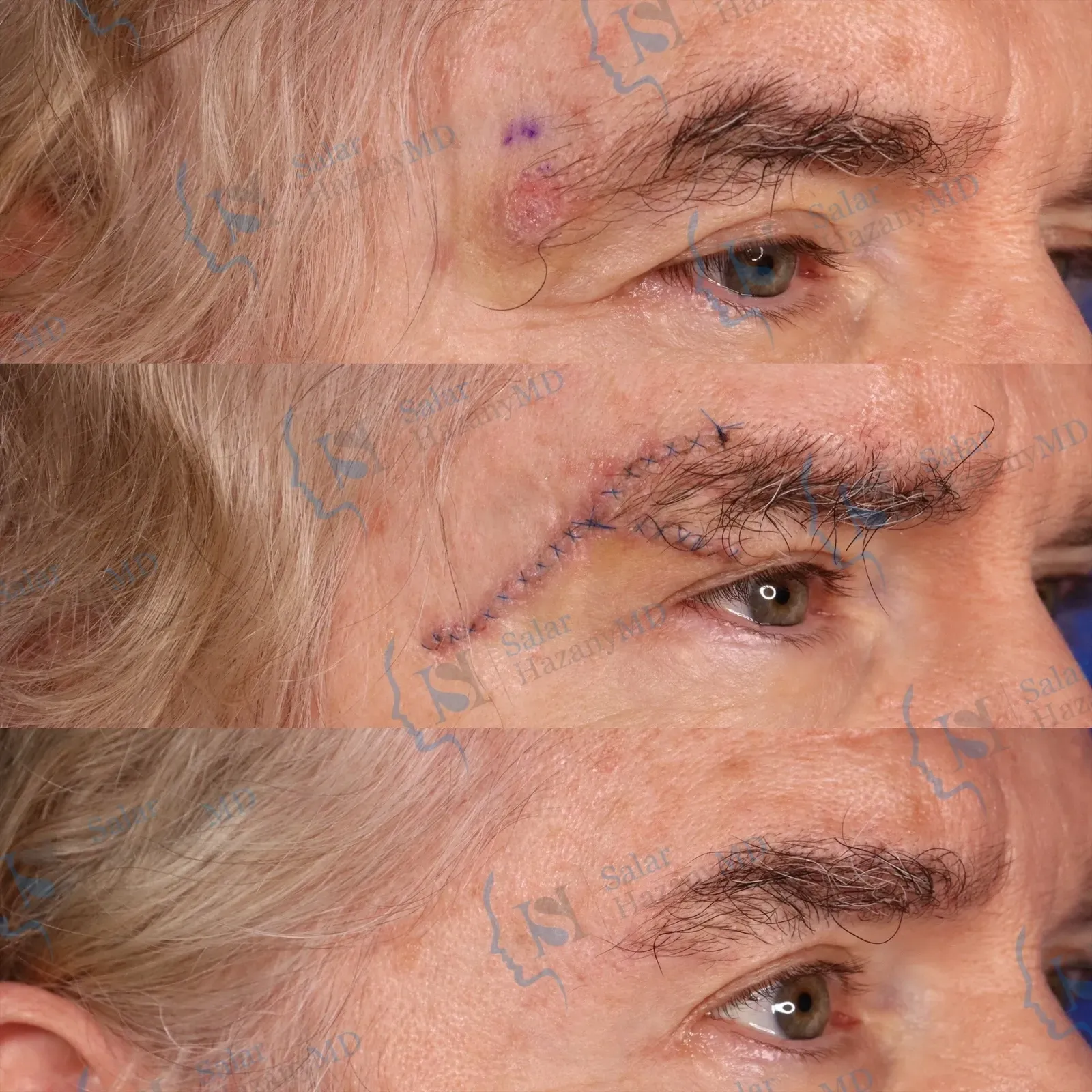 A close up of a person 's skin with the name salar hazany md on the bottom