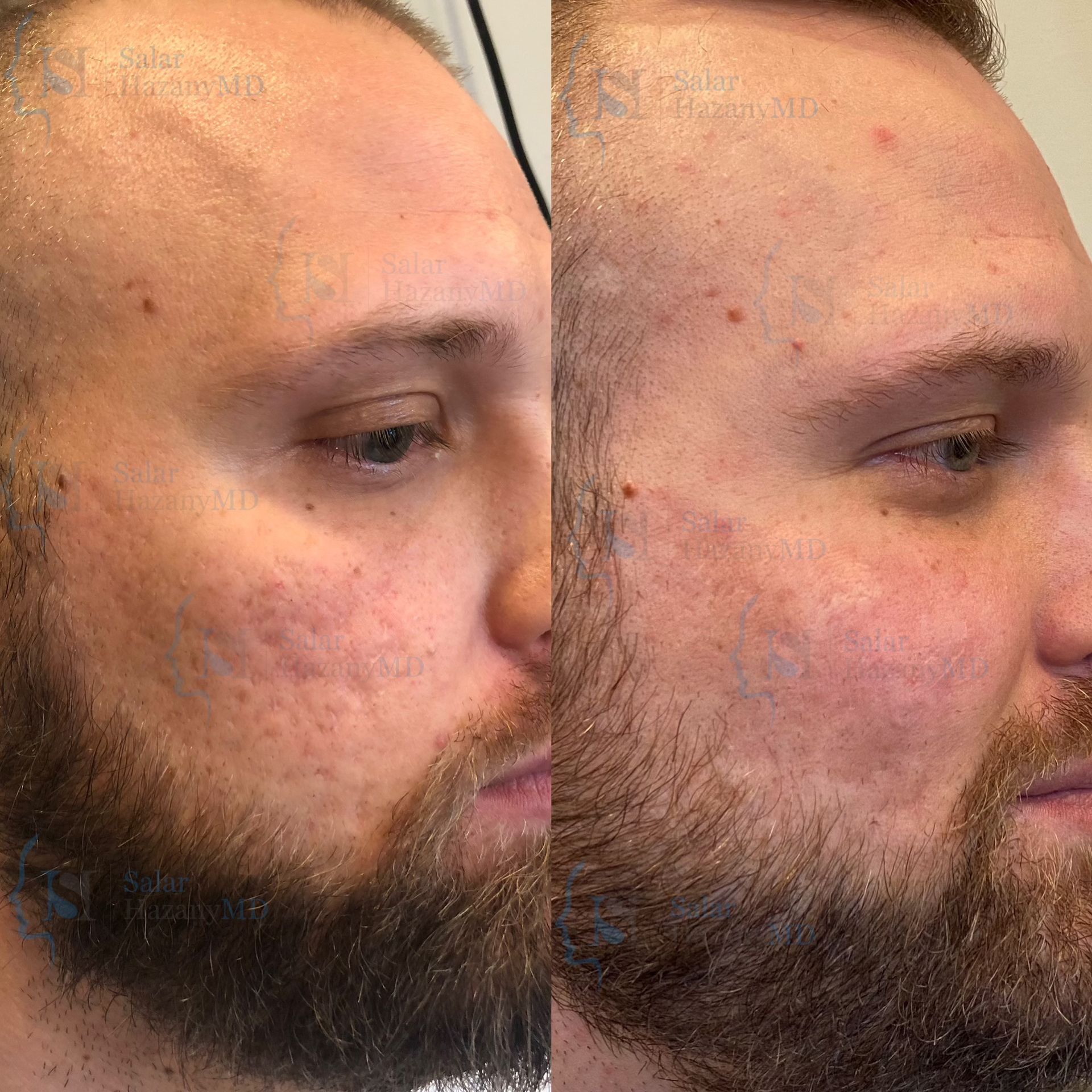 A before and after photo of a man 's face