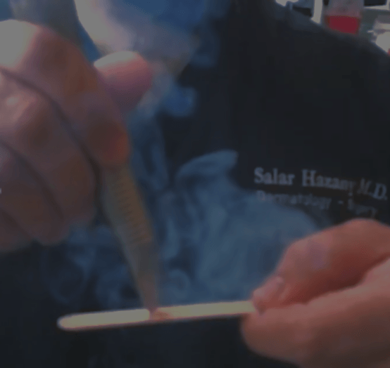 Slightly Blurred Image of Dr. Salar Hazany Testing His Laser on a Wooden Test Stick