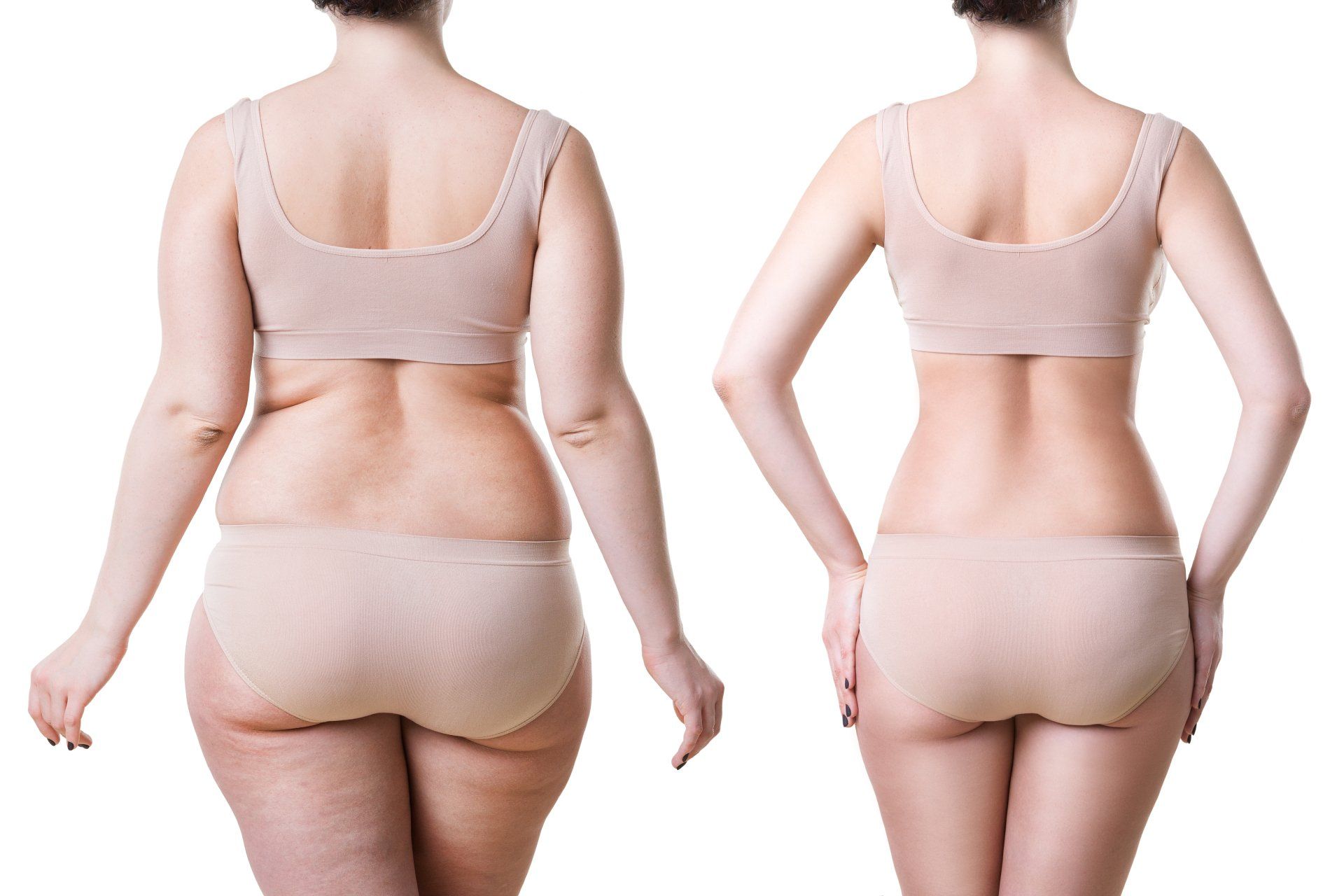 Stock Photo Woman S Body Before And After Weight Loss Isolated On White Background Plastic Surgery Concept 1114520672 1920w 