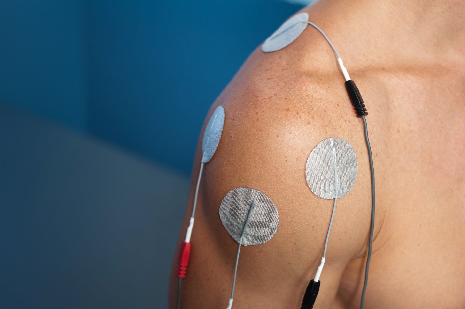 A close up of a person 's shoulder with electrodes on it.