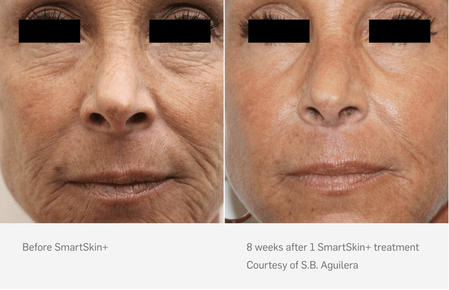 El Segundo Dermatology | LASER & LIGHT TREATMENTS