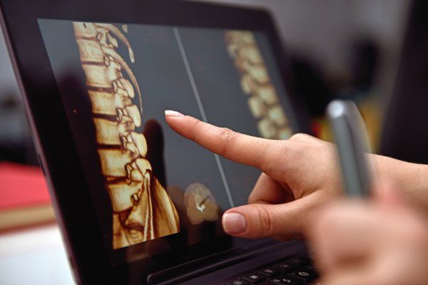 Spine Treatment — Chattanooga, TN — Vaughn Spine and Orthopedics P.L.L.C.