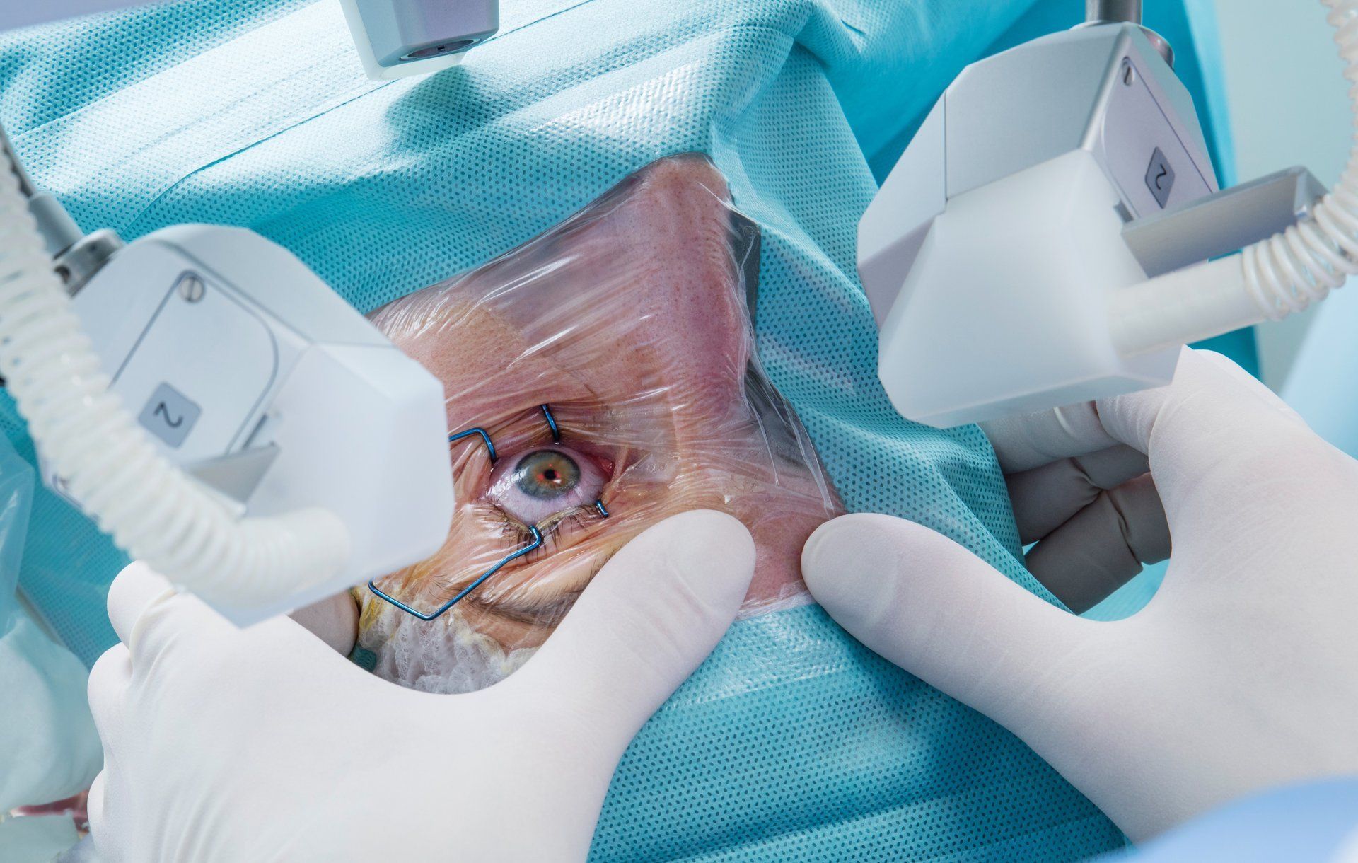 Microchirurgia oculare