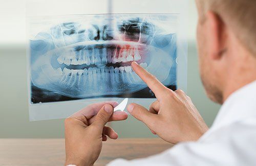 medico guarda radiografia dei denti
