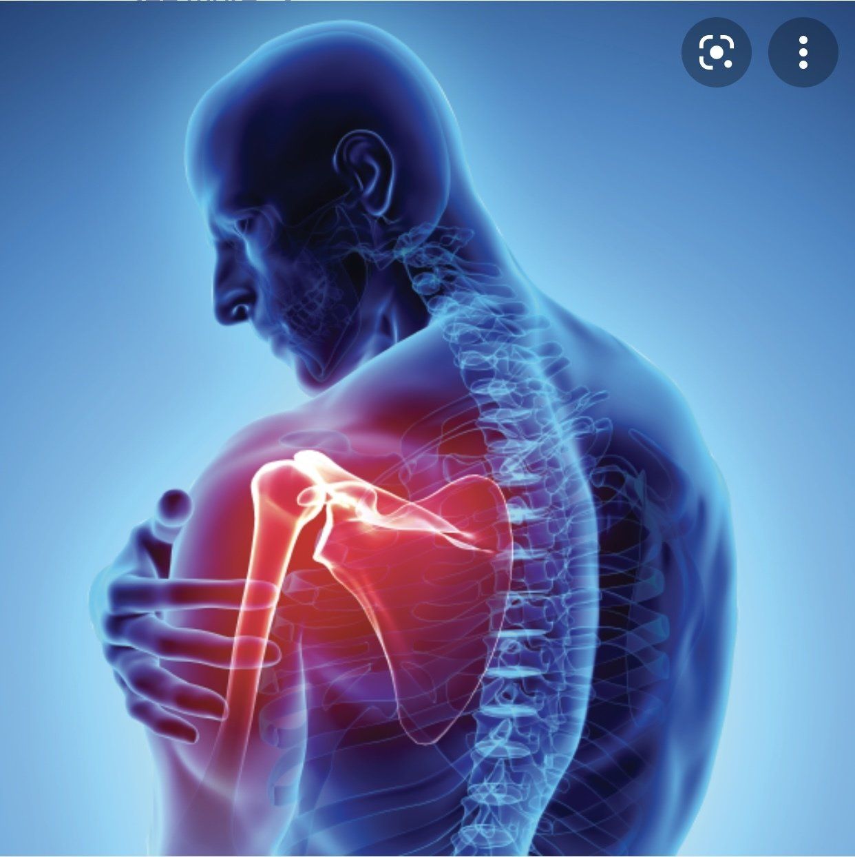 Shoulder Pain — Nationwide — Bringing Balance Back