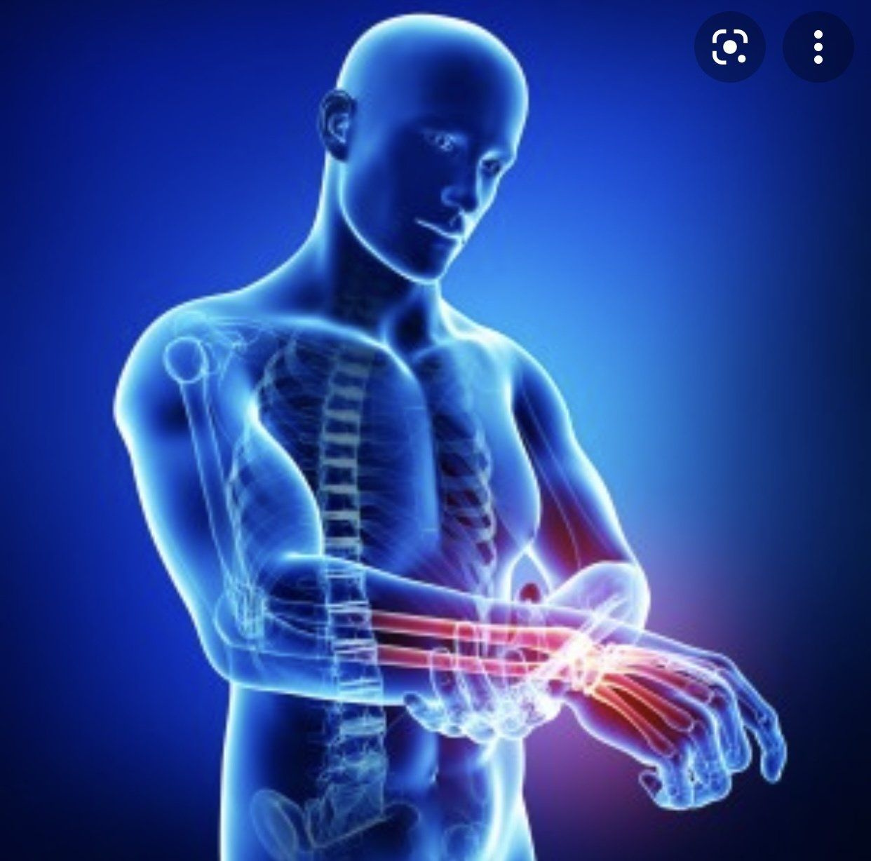 Arm Pain — Nationwide — Bringing Balance Back