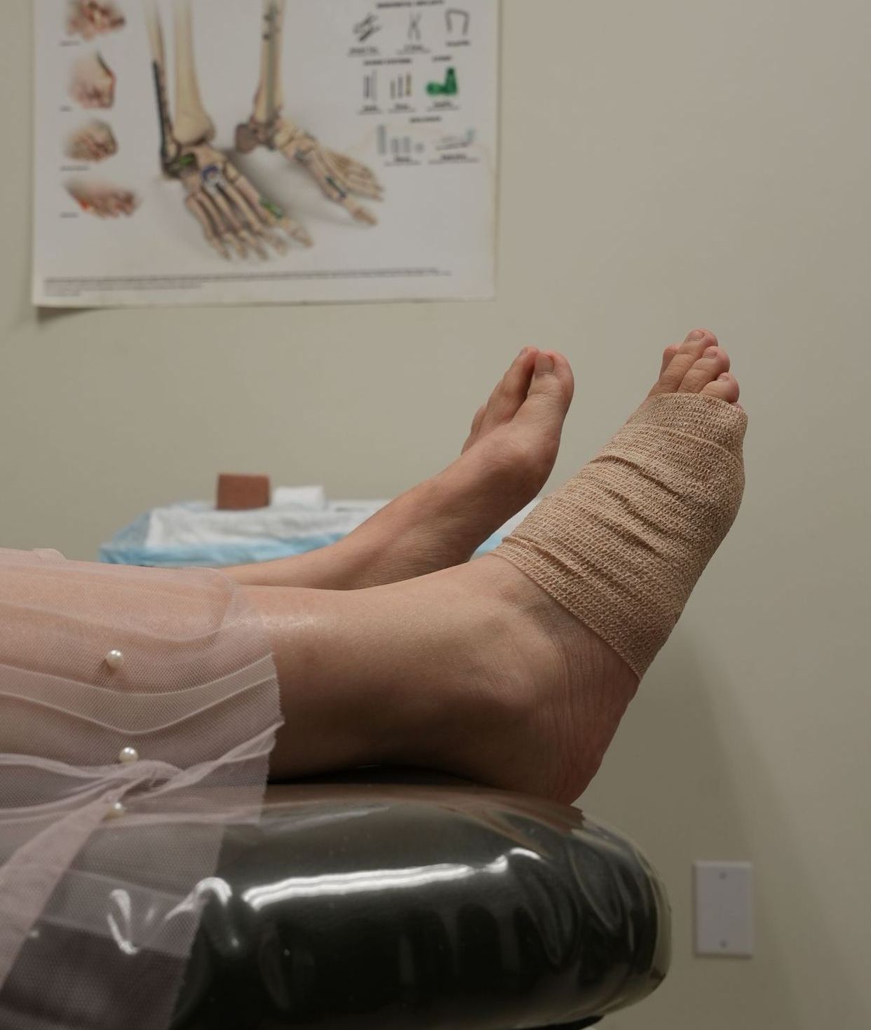 FOOT AND ANKLE NONSURGICAL TREATMENT