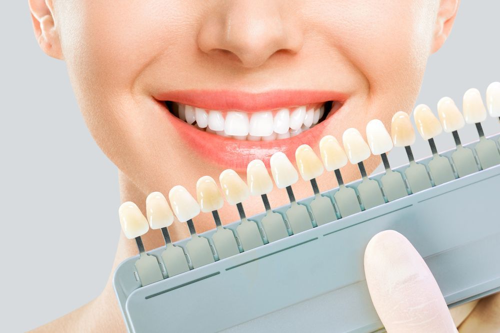 A woman is smiling while holding a tooth color chart in front of her teeth.