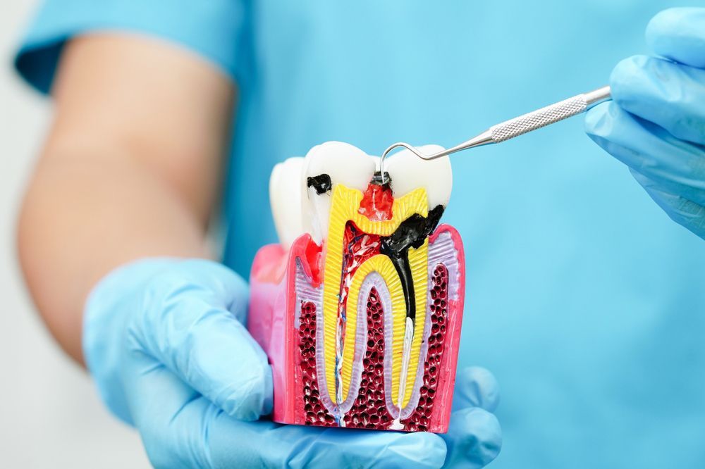 A dentist is examining a model of a tooth with a toothbrush.