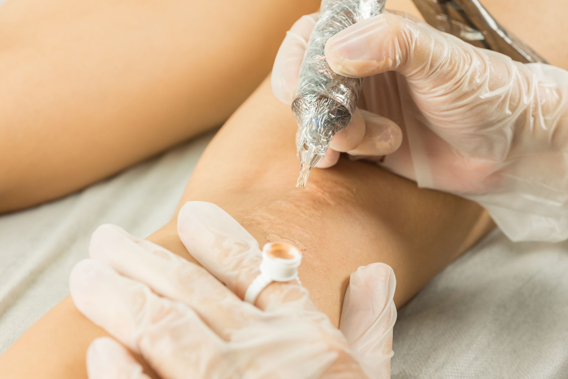 A person is getting a tattoo on their arm.