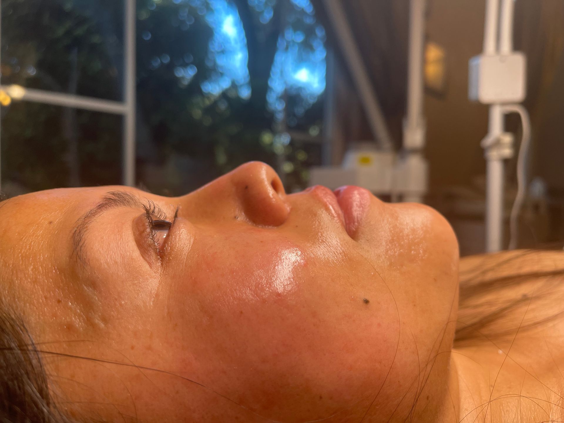Professional dermaplaning facial treatment at The Skin Clinique in Santa Rosa to smooth and brighten