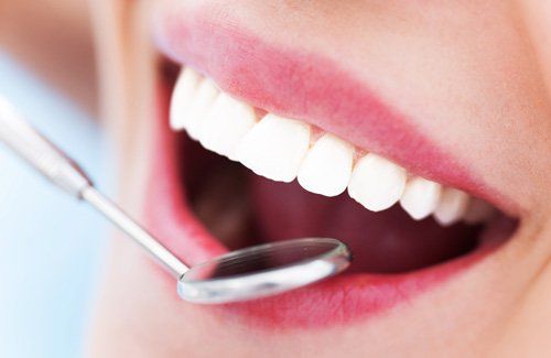 Root Canal — Dentist Check Up in Lexington, KY