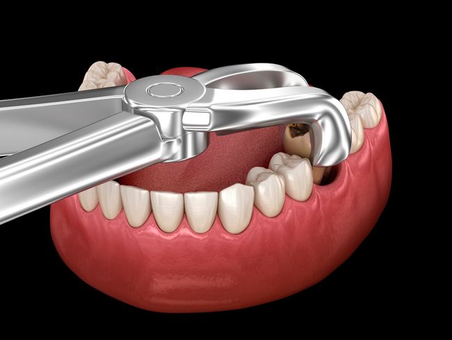 Un gruppo di dentisti sta lavorando su un paziente in una sala operatoria